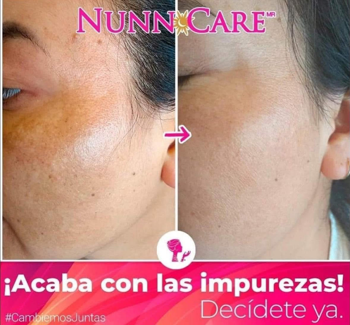 Crema Nunncare