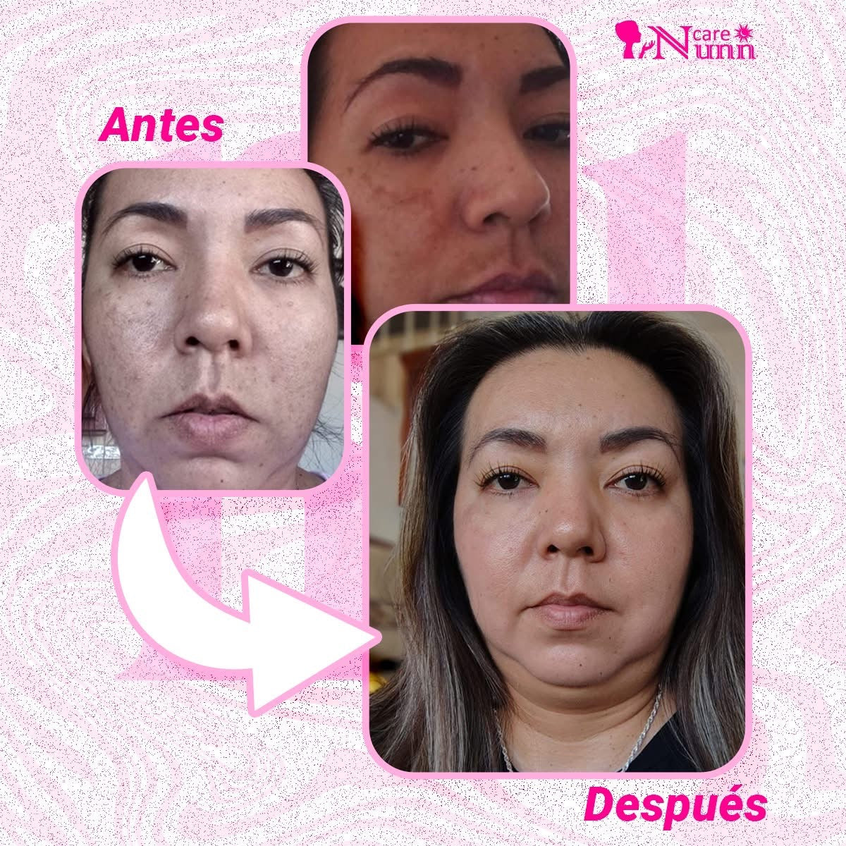 Crema nunncare
